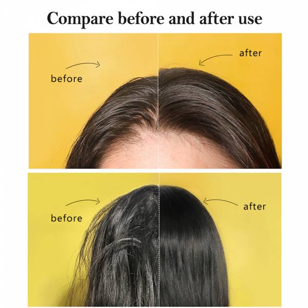 Shampoo