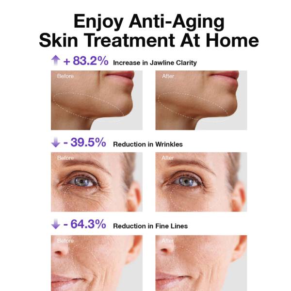 Facial Toning & Light Therapy Devices