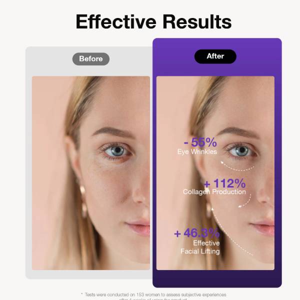 Facial Toning & Light Therapy Devices